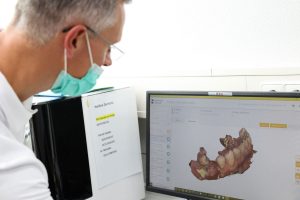 Der Anteil digitaler Daten vom Zahnarzt nimmt zu