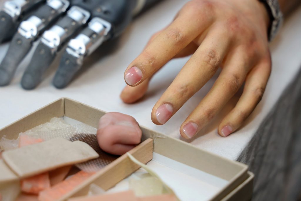 Jurybesuch bei der Lifelike Prosthetics GmbH